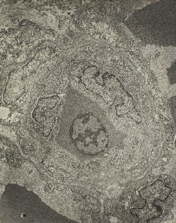 zdjęcie spod mikroskopu elektronowego